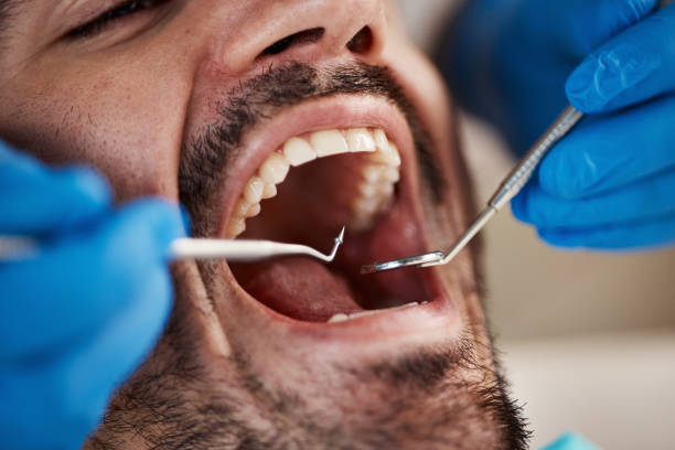 Fast & Reliable Emergency Dental Services in MN